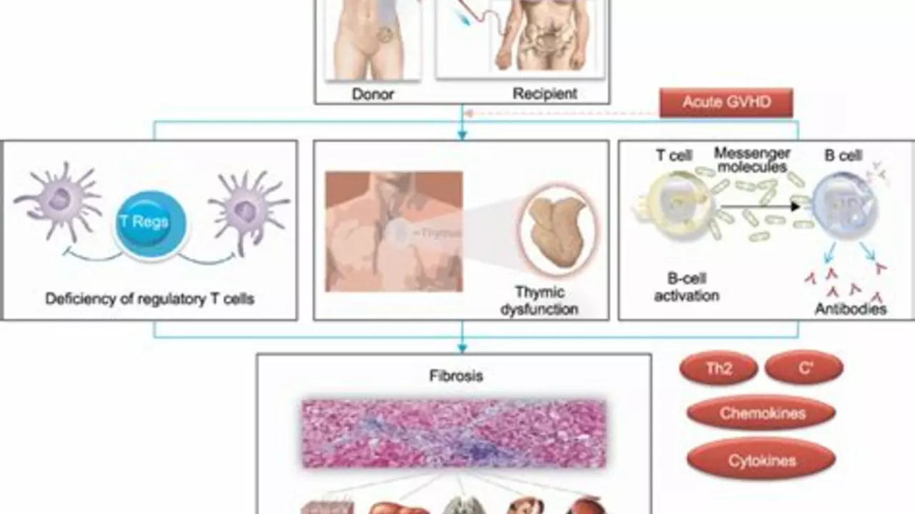 The Connection between Cell Lymphoma and Graft-versus-Host Disease